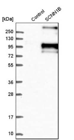 epithelial Sodium Channel beta Antibody, Novus Biologicals 25ul | Buy Online | Novus Biologicals | Fisher Scientific